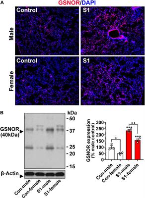 Efficacies of S-nitrosoglutathione (GSNO) and GSNO reductase inhibitor in SARS-CoV-2 spike protein induced acute lung disease in mice